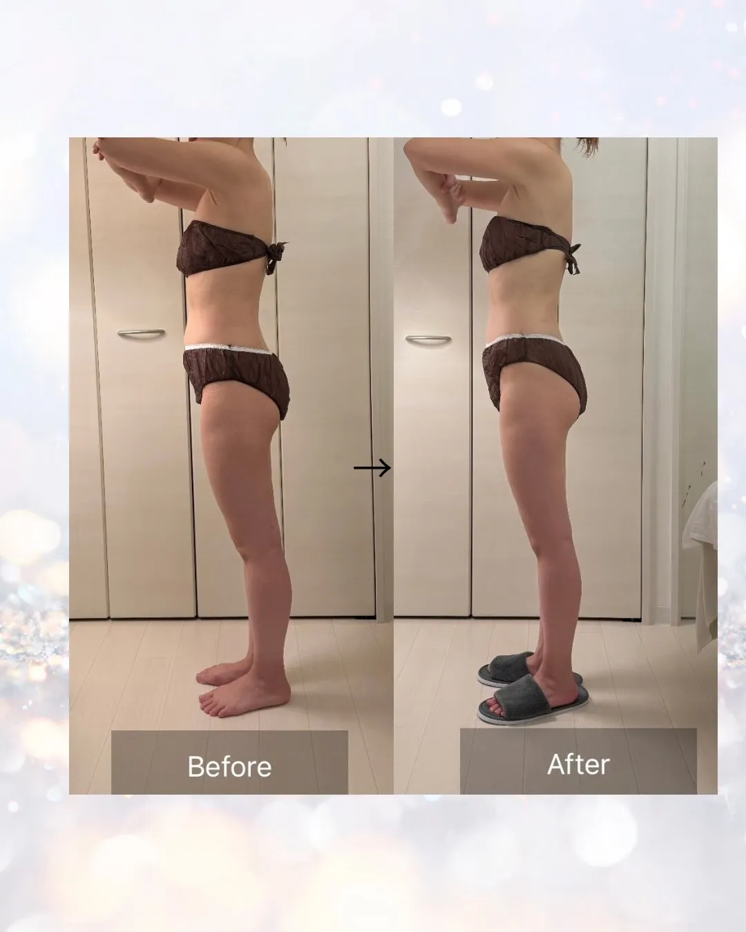 インディバ施術1回の変化です💆♀️✨