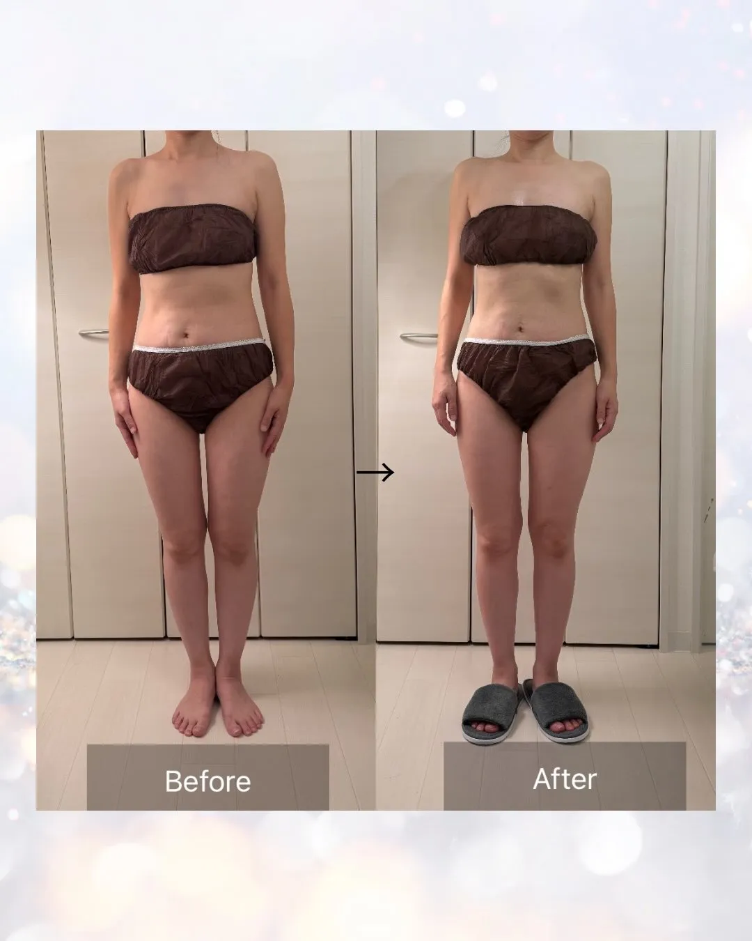 インディバ施術1回の変化です💆♀️✨